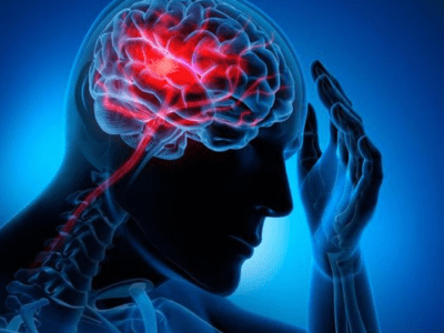 Phòng tránh tai biến mạch máu não: Giải pháp cần thiết cho đối tượng ngoài 50 tuổi 6 image5765