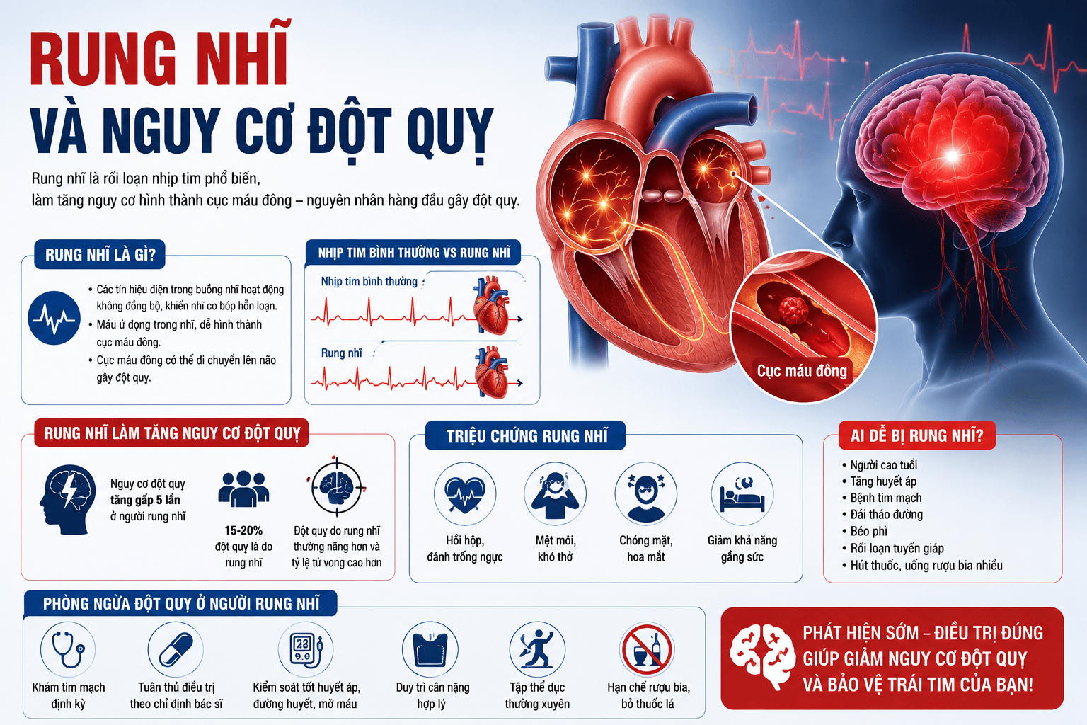 Rung Nhĩ Và Nguy Cơ Đột Quỵ: 5 Nhóm Đối Tượng Không Được Chủ Quan? 2 rung-nhi-va-nguy-co-dot-quy